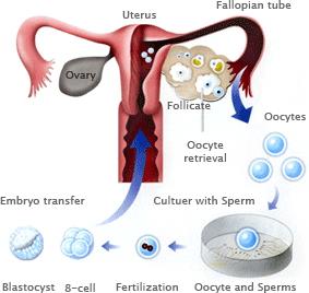 CHA Fertility Center