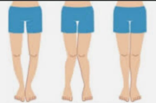 children And woman in sports mcq