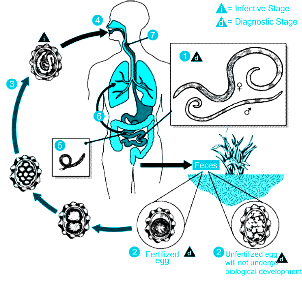 Ascariasis - Infectious Diseases - MSD Manual Professional Edition