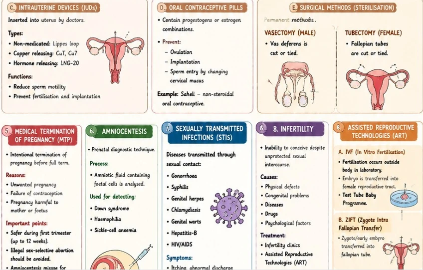 CBSE Class 12 Biology one-page revision notes on Reproductive Health, covering intrauterine devices (IUDs), oral contraceptive pills, surgical sterilisation